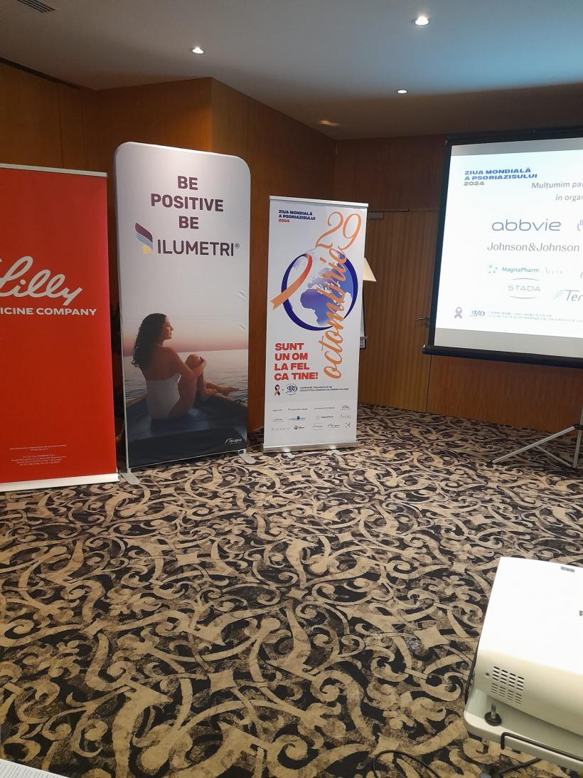 A 5-a cea mai importantă boală cronică necontagioasa la nivel mondial. 400.000 de români suferă de psoriazis 18924815