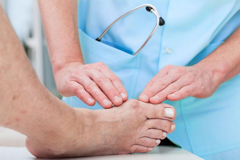 Ce trebuie să știi despre gută. Simptome și tratament