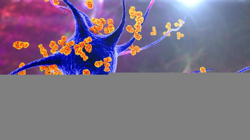 Tratament revoluționar pentru bolile autoimune: vaccinurile inverse 18954434