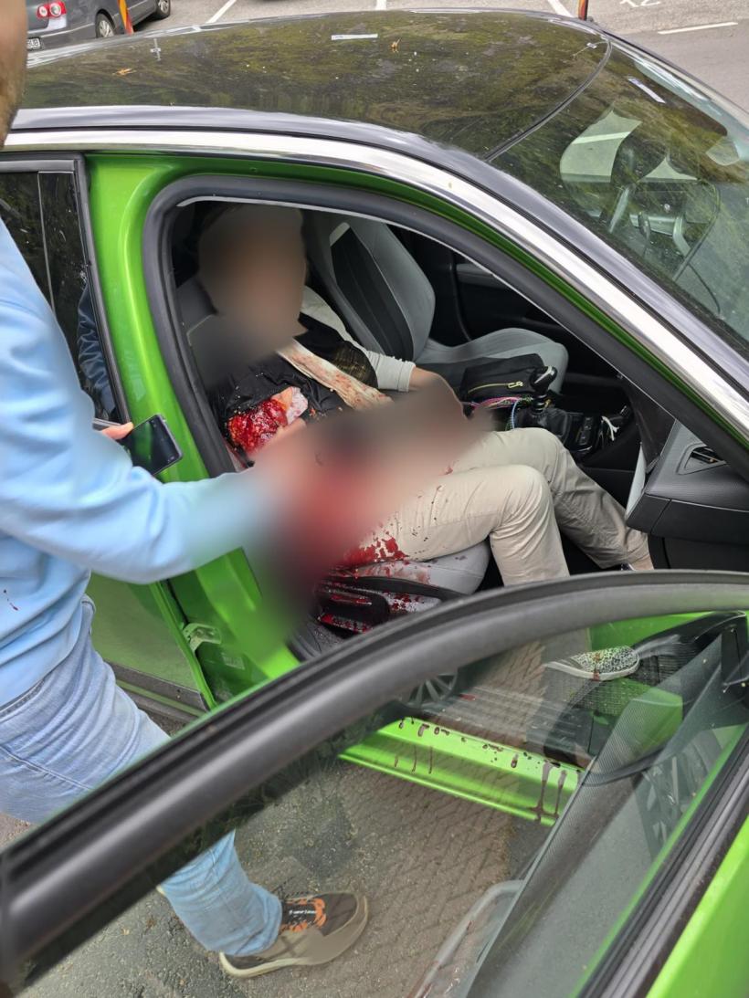 Turistă străină mușcată de urs în zona barajului Vidraru. Atenție: Imagini șocante!