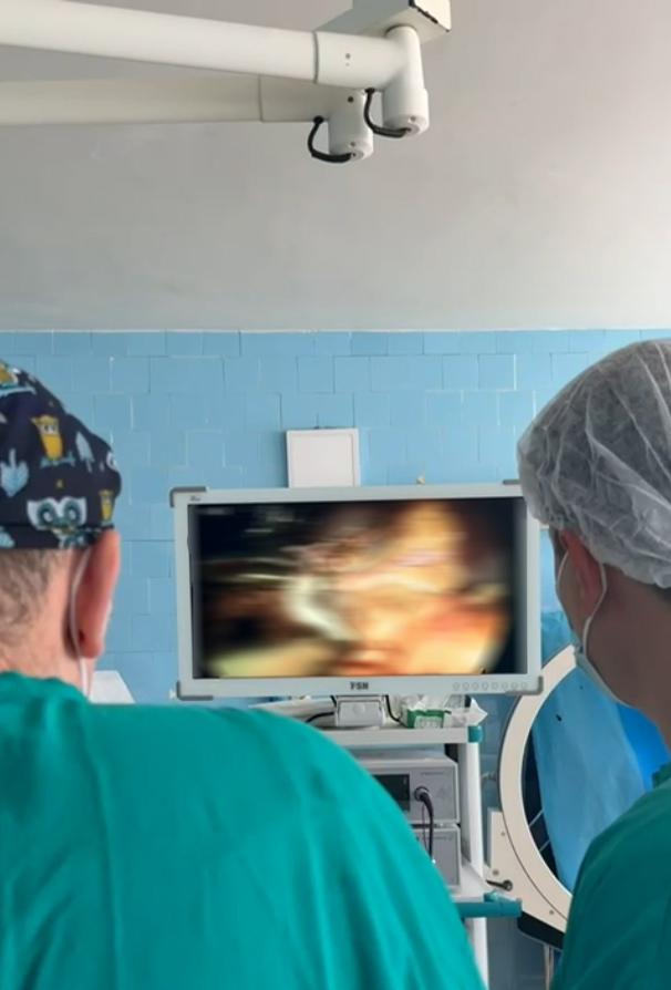 Procedură rară la un spital din Galați: Operație laparoscopică de îndepărtare a unui rinichi 18964329