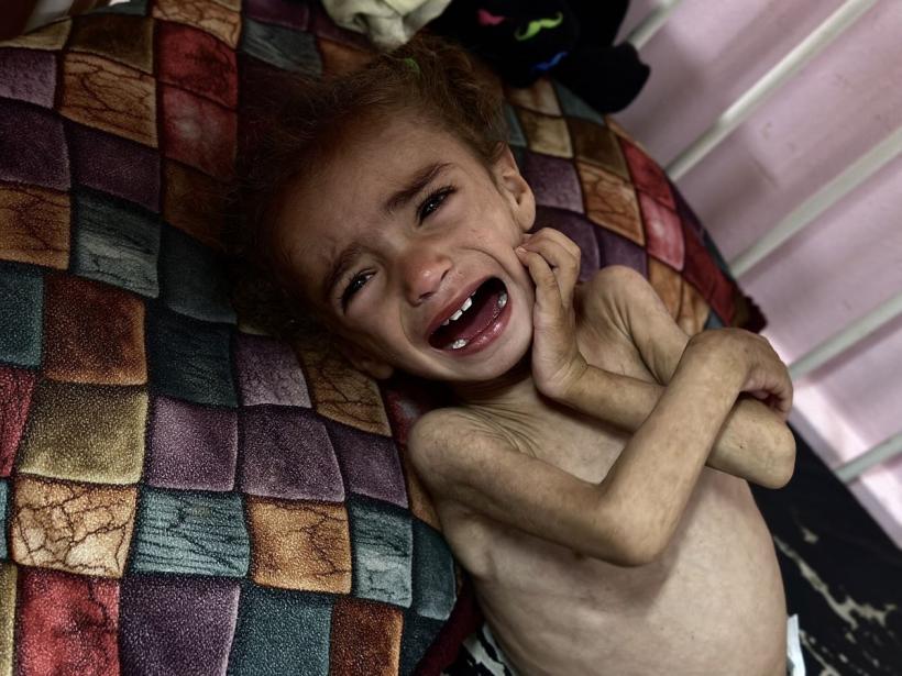 Foamete în Fâșia Gaza. Malnutriție severă la copii. Populația afectată de ordine de evacuare  18964877