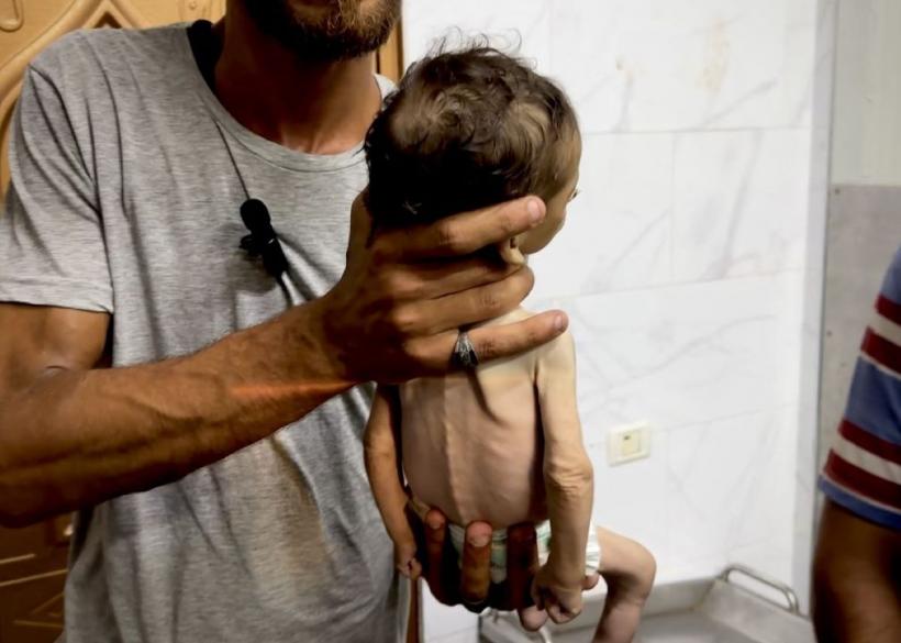 Foamete în Fâșia Gaza. Malnutriție severă la copii. Populația afectată de ordine de evacuare  18964878