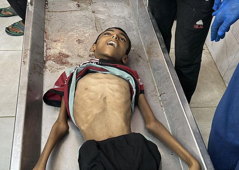 Foamete în Fâșia Gaza. Malnutriție severă la copii. Populația afectată de ordine de evacuare  18964879