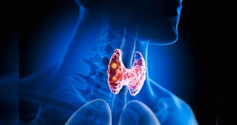 Dr. AI are auzul mai fin decât medicii: poate detecta cancerul de laringe doar ascultând vocea pacienților 18967899