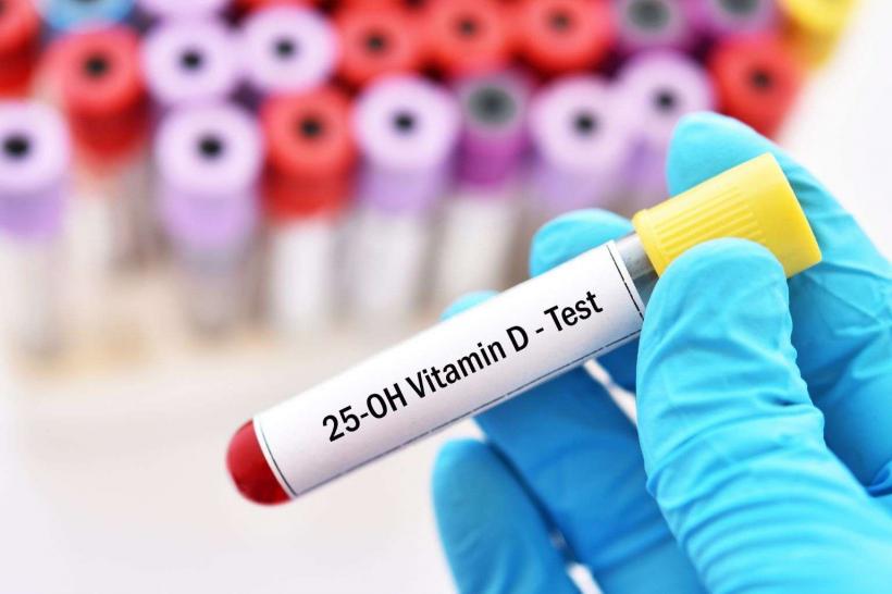 „Programul vitamina D”, resuscitat în Parlament