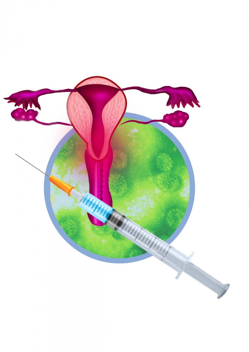 România rămâne țara cu cea mai mare mortalitate prin cancer de col uterin în UE: experți și decidenți cer acțiuni rapide pentru prevenție, vaccinare și screening