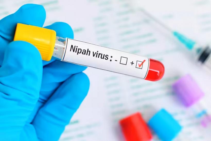 Două virusuri ignorate pot provoca epidemii sau pandemii 