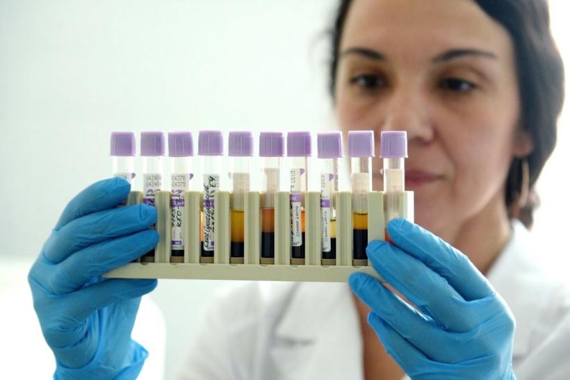 Analizele de sânge arată în ce măsură diabetul afectează rinichii