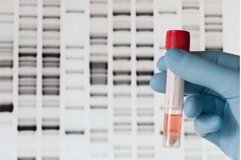 Test nutrigenetic: indicații, rezultate și criterii de alegere a laboratorului genetic