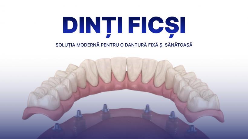 Dinți ficși: cui se potrivesc și cum se formează prețul în București, România