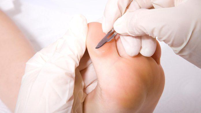 4 pași simpli pentru picioare perfecte: Trucul ieftin care face minuni pentru călcâiele tale