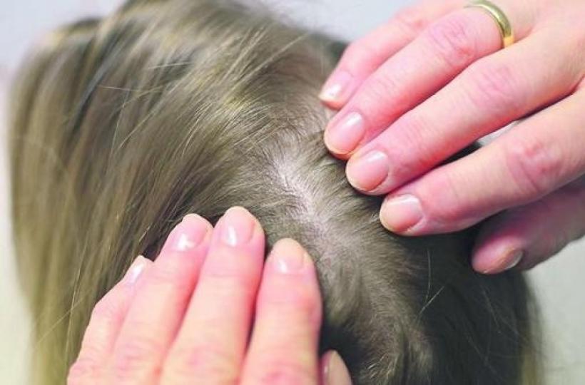 Cum să oprești cădera părului? Soluția naturală care te ajută să ai un păr des și strălucitor