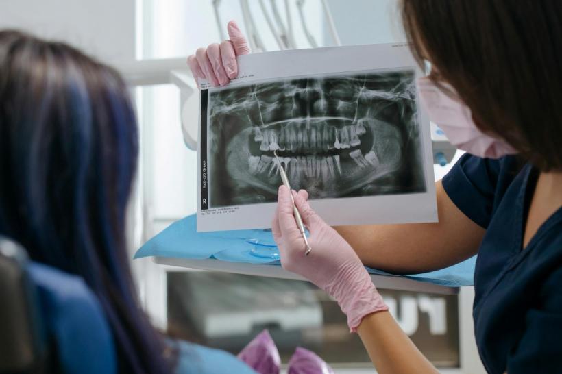 De la ce vârstă se poate face un implant dentar