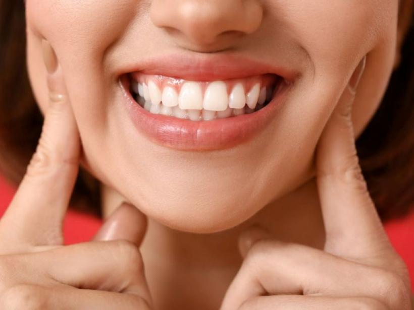 Cum influențează sănătatea gingiilor rezultatul unui tratament de estetică dentară?