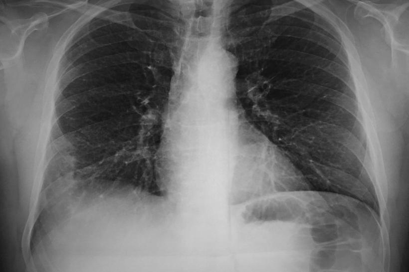 Misterul tinereții a fost descifrat: Organul banal care controlează cât de repede îmbătrânești