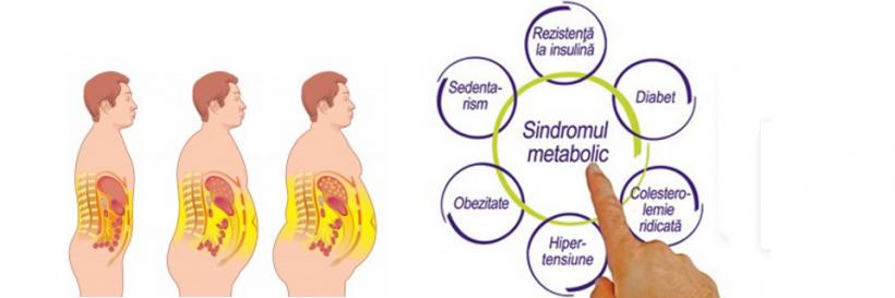 Sindromul metabolic - mănunchiul de maladii fatale  19012446