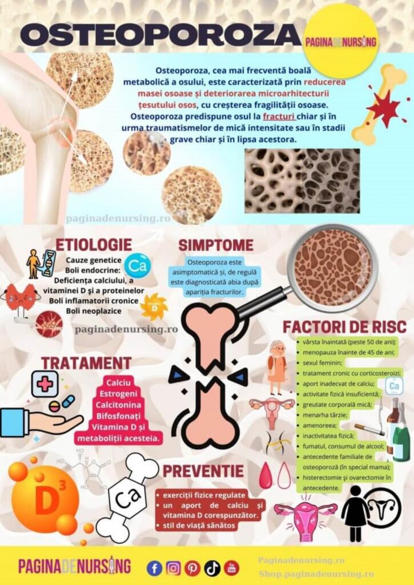 Osteoporoza, boala care ne macină oasele 19013336