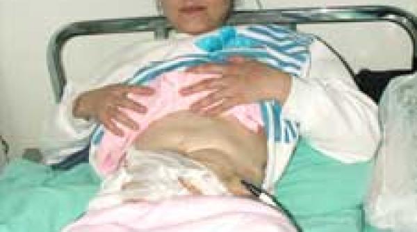 viata amara operata de 51 de ori in 22 de ani