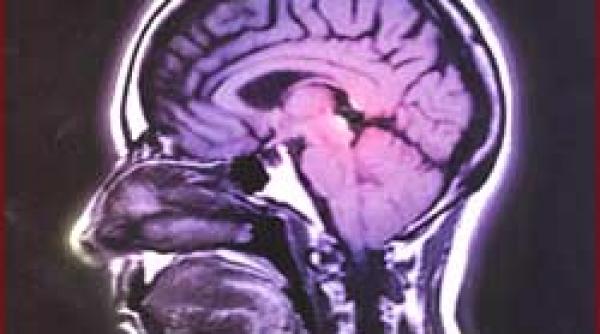 reteta rugaciunea calmant al durerilor cronice