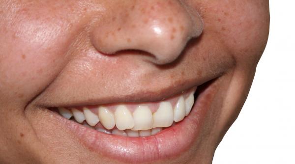 dovezi sanatatea si munca