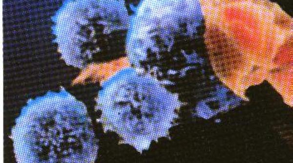 sida si sistemul nervos