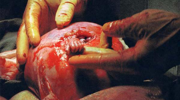 blog tudor chirila jurnalul unui embrion