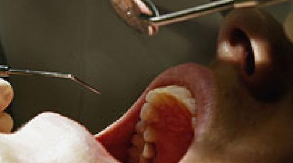 o plomba dentara in marea britanie mai scumpa decat salariul romanilor