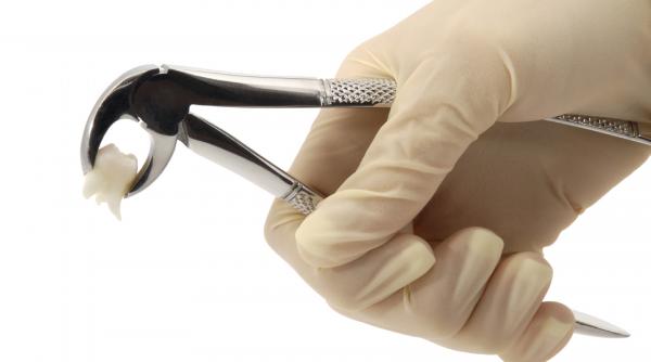 stomatologie fara durere