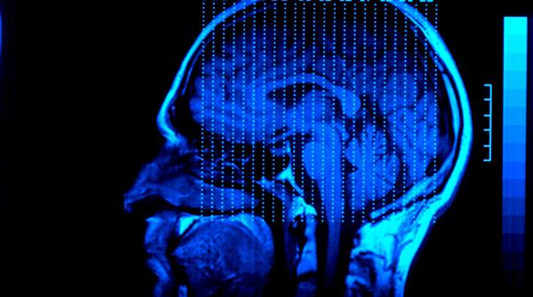 durerea cronica afecteaza creierul