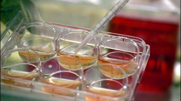 cluj s a deschis prima banca de celule stem din romania