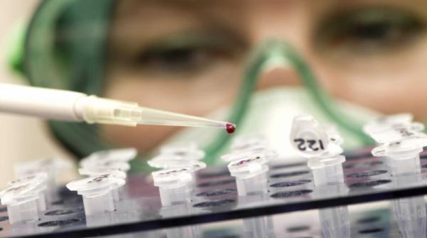 test rapid pentru tbc