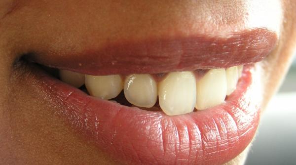 stop caderii dintilor