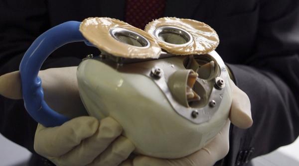 o noua inima artificiala