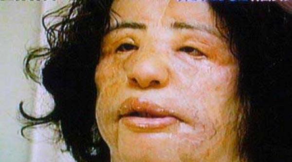 cand chirurgia estetica naste monstri