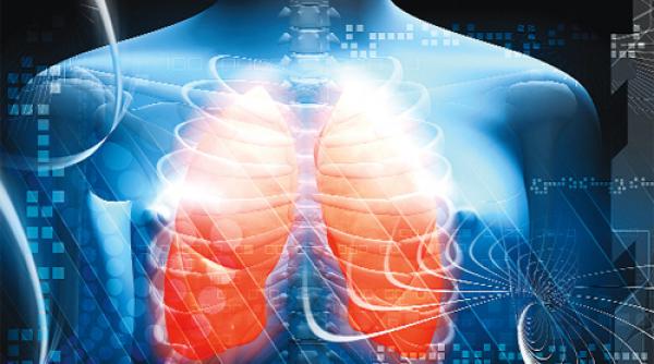 sfatul medicului pneumonia