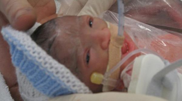 miracol bebelus nascut din mama moarta