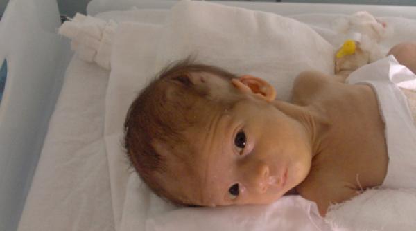 caz rar icirc ntalnit copila noastra putrezeste de vie