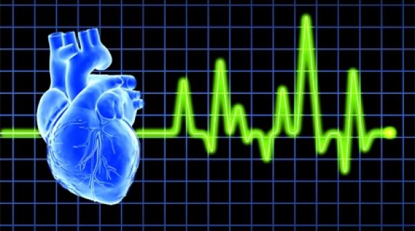 infarctul de miocard