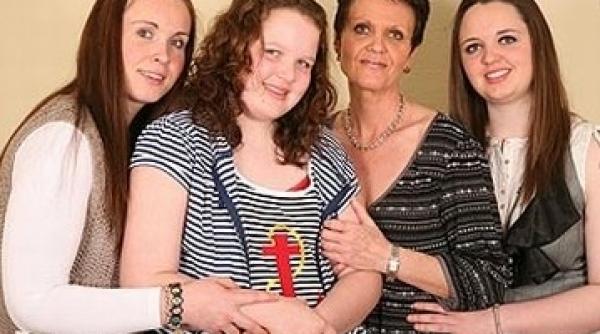 o boala genetica o transforma in statuie