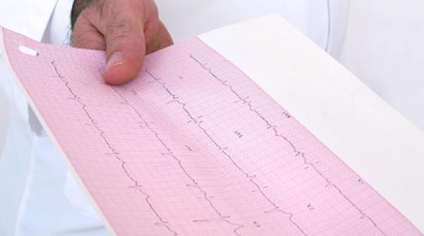 arteriopatia cronica obstructiva