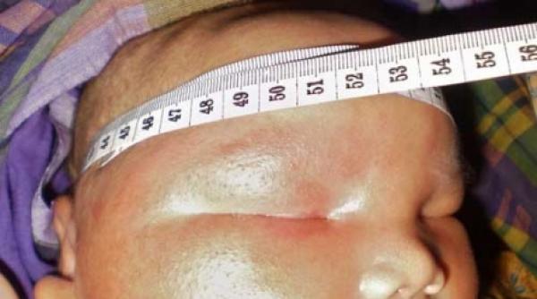 bebe de 8 7 kilograme