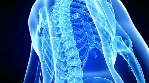 osteoporoza vine dupa 50 de ani