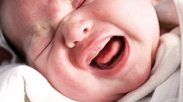 suferinte de bebelus