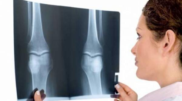 genunchiul mult mai complex decat o balama