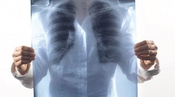 necazuri si iar necazuri in plamani