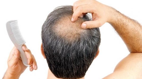 chelia nu mai e la moda