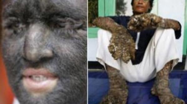 respinsi de oameni din cauza bolilor de care sufera