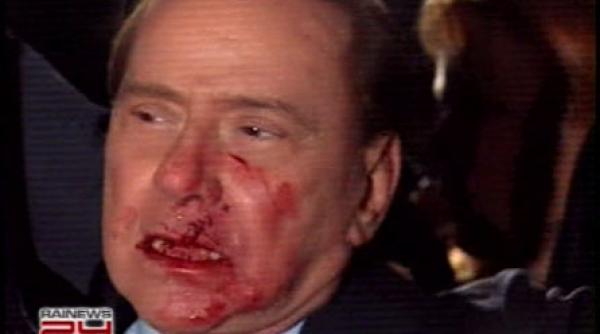 vanatai si dinti rupti video