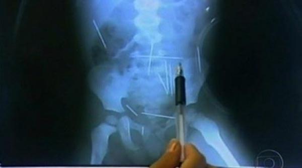 copil de doi ani victima magiei negre